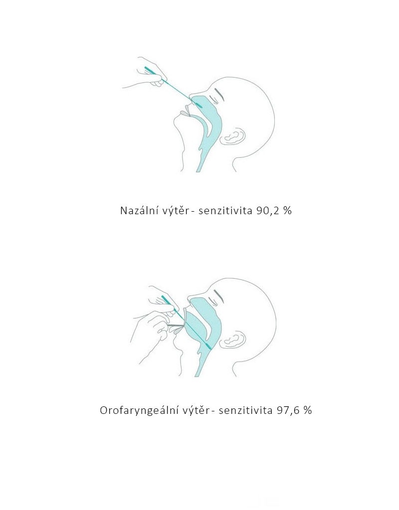 Antigenní test tyčinkový, NADAL® COVID-19 Ag Test, vyrobeno v Německu